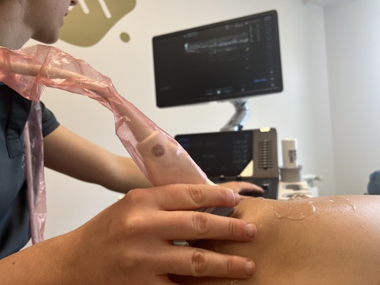 Ecografía musculoesquelética en Donostia 3