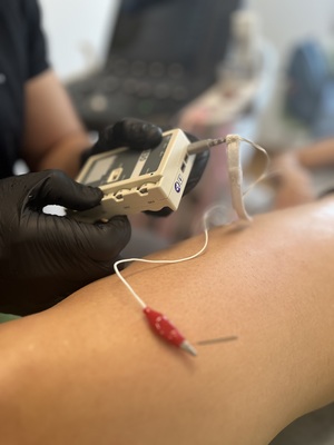 Neuromodulación percutánea ecoguiada en Donostia 2